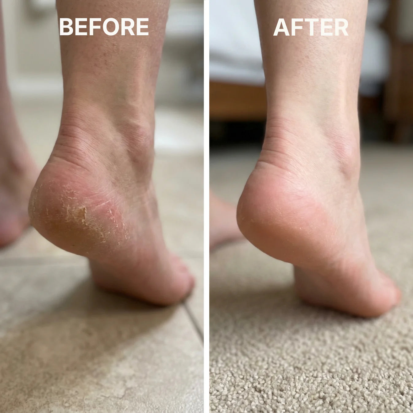 Vara Anti-Fungal Jock Itch Soothing Soap™